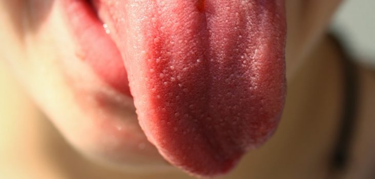 Bild: Die Zunge hat, anders als oft behauptet, keine einzelnen Regionen für die verschiedenen Geschmäcker. Es gibt keine Zungenlandkarte.
